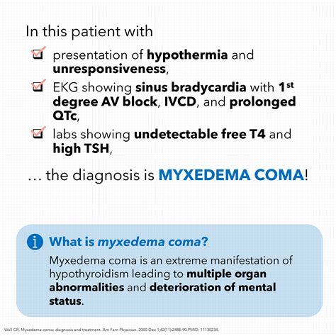 Myxedema Coma | Core IM Podcast