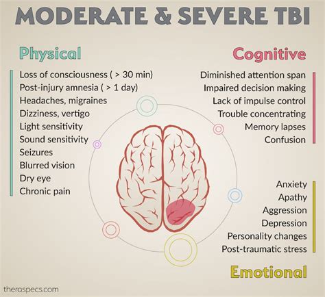 Concussion symptoms – Artofit