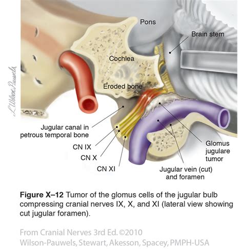 Jugular Foramen Cranial Nerves