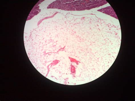 Adipose Tissue – howMed