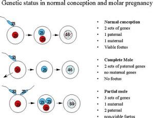 Introduction to Molar Pregnancy – Charing Cross Gestational Trophoblast ...