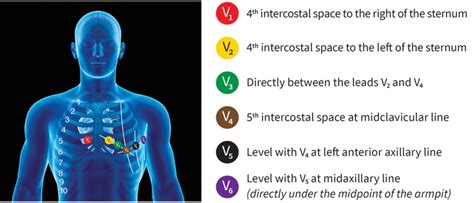 [DIAGRAM] Ecg Lead Placement Guide Diagram - MYDIAGRAM.ONLINE