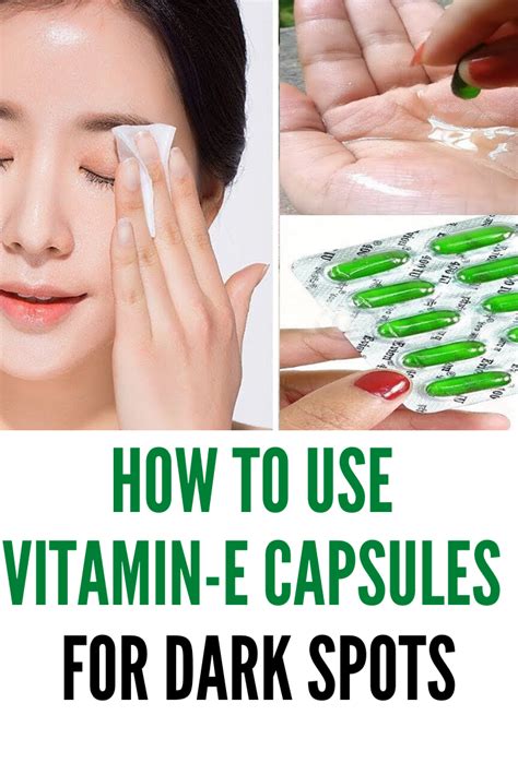 Benefits Of Vitamin E Capsules | How To Use For Skin and Hair ...