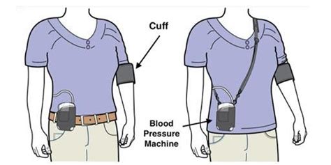 ABM - 24H Ambulatory Blood Pressure Monitoring