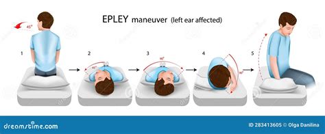 Epley Maneuver Left Ear Affected Vector Illustration | CartoonDealer ...