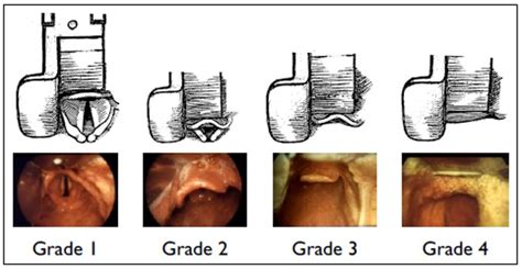 Airway Evaluation - Dr. Paul Mirdamadi DDS