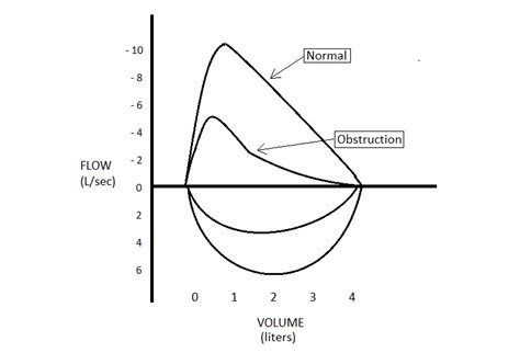 Top 5 Spirometry Tips for COPD Diagnosis and Management | RT