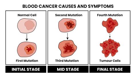 Blood Cancer - Types, Symptoms, Causes and its Treatment