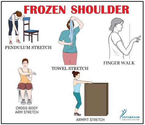 5 Effective Exercises for Frozen Shoulder - Blog