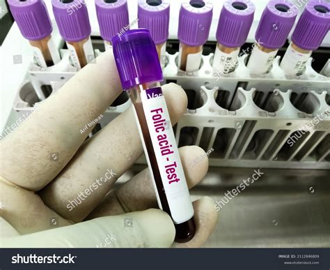 Blood Sample Folic Acid Folate Test Stock Photo 2112846809 | Shutterstock