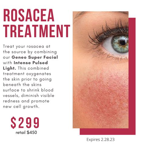 Rosacea Treatment | Advanced Skin + Body Aesthetics