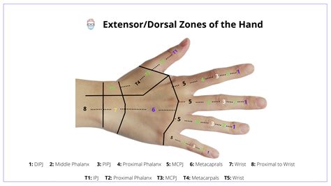 Flexor Zones Of The Hand