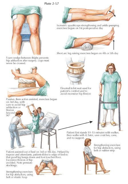 REHABILITATION AFTER TOTAL HIP REPLACEMENT Hip Replacement Exercises ...