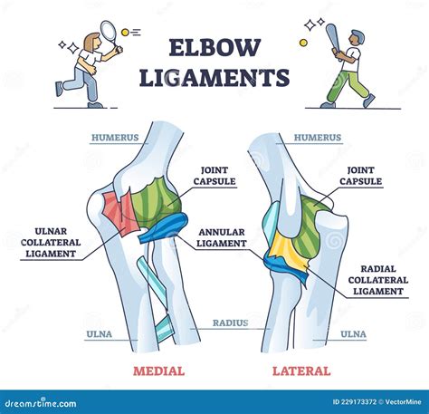 Elbow Ligaments with Medical Medial or Lateral Xray Structure Outline ...