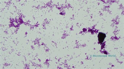 Microscope World Blog: Diphtheria under the Microscope