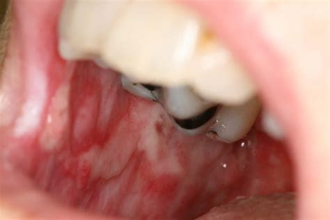 Diseases of the mouth and face - CENTER FOR INTEGRATIVE ORAL HEALTH