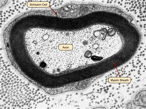 This electron micrograph shows a cross section of a myelinated nerve in ...