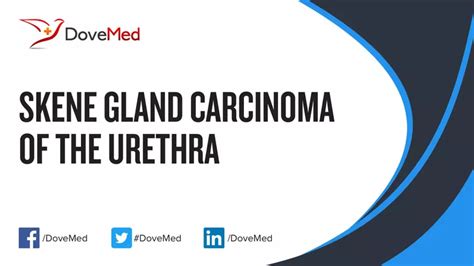 Skene Gland Carcinoma of the Urethra - DoveMed