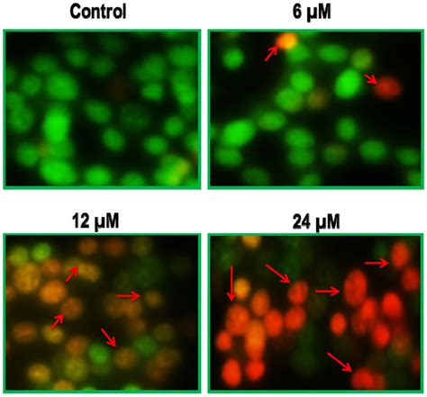 Fluorescence microscopy using acridine orange/ ethidium bromide (AO/EB ...