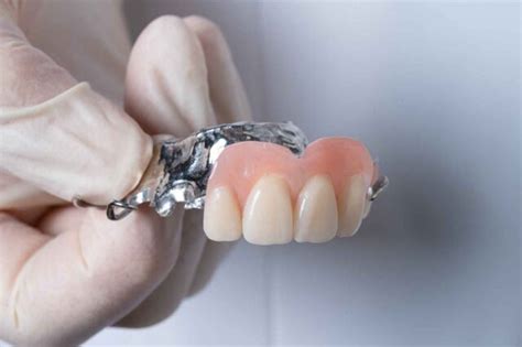 FAQs About Chrome Dentures