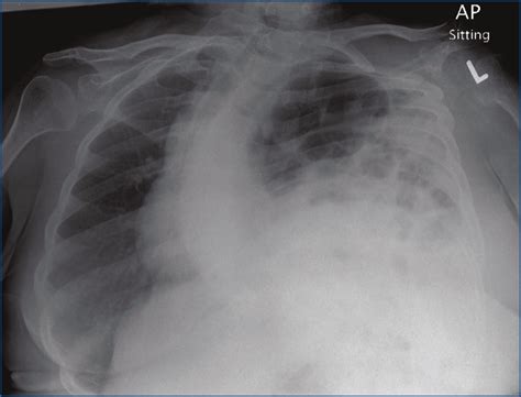 Laryngeal Manifestations of Respiratory Disorders | Ento Key