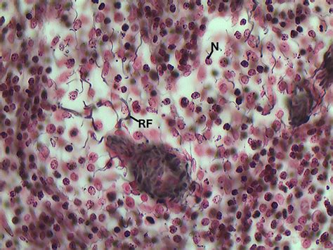 Reticular Connective Tissue, 40X | Histology