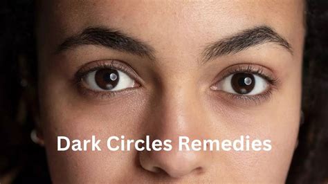 Remove Dark Circles | 15 Natural Remedies To Get Rid of Dark Circles ...