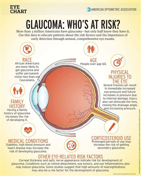 Pin on Glaucoma & Cataracts