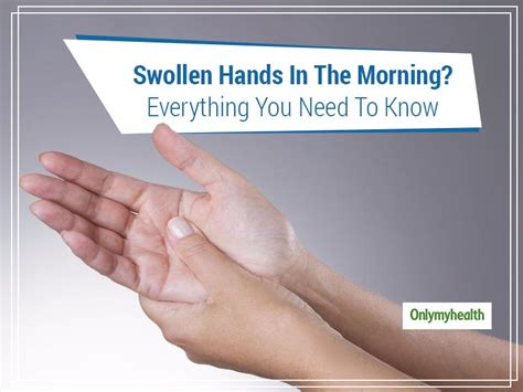 Wave Goodbye To Swollen Hands In The Morning By Learning Its Causes And ...