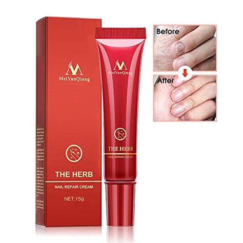 Buy Fungus Nail Cream, Fungus Stop, Nails Repair Cream,Anti Fungus Nail ...