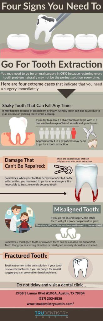 Do And Don'ts Before And After Tooth Extraction?