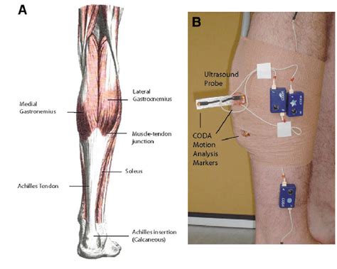 (A) Anatomy of the triceps surae muscle group and the Achilles tendon ...