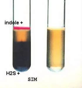 Hydrogen Sulfide Test - Procedure, Uses and Interpretation ...