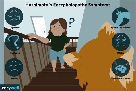 Hashimoto's Encephalopathy: Overview and More