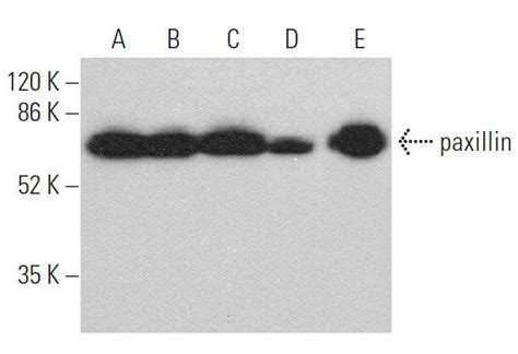 paxillin Antibody (B-2) | SCBT - Santa Cruz Biotechnology