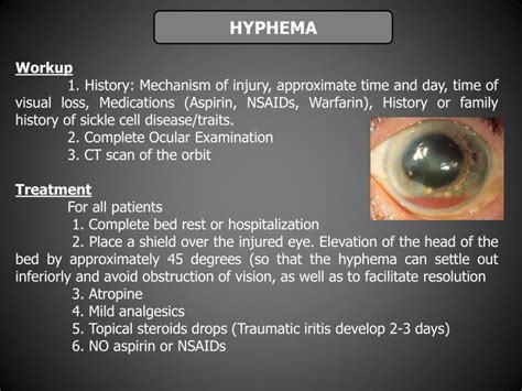 PPT - OCULAR TRAUMA. DIAGNOSIS AND TREATMENT. PowerPoint Presentation ...