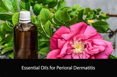 Essential Oils for Perioral Dermatitis: Natural Remedies to Relieve