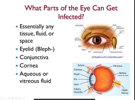 Understanding Common Eye Infections - Eye & Ear Foundation of Pittsburgh