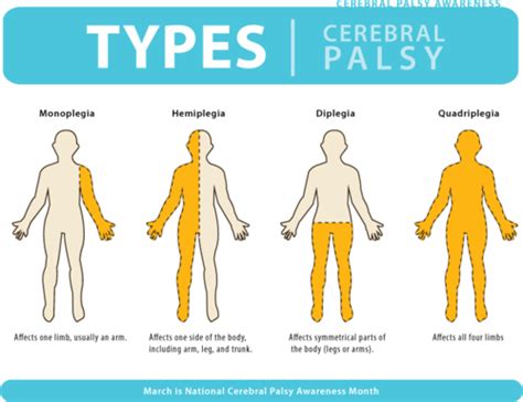 Cerebral Palsy Flashcards | Quizlet