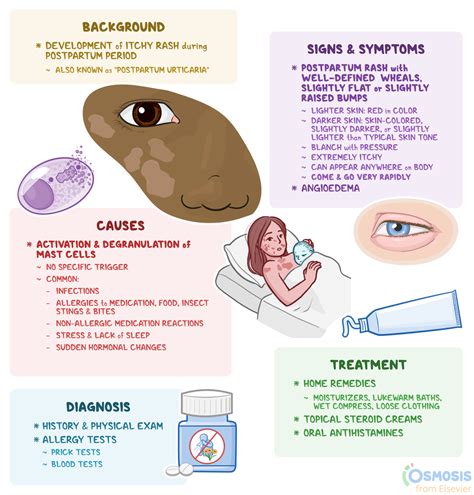 Postpartum Hives: What Are They, Causes, Symptoms | Osmosis