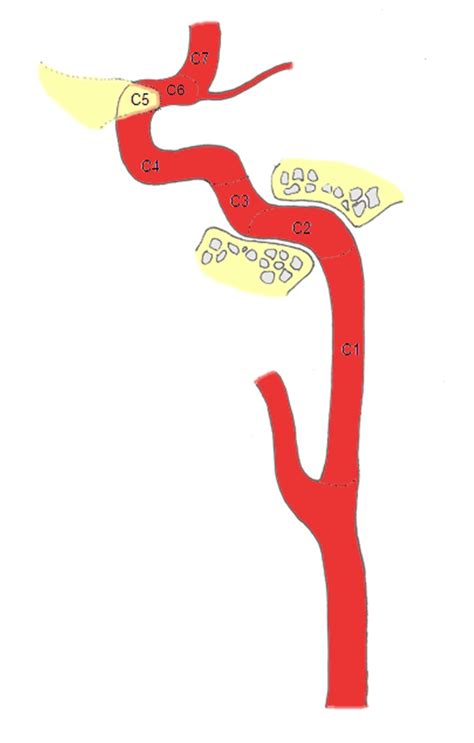 C1 (cervical segment) begins at the level of the common carotid artery ...