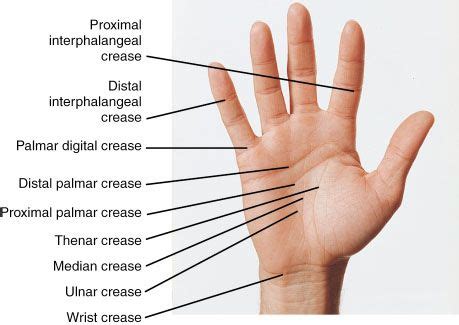 Evaluation of Hand Edema: Assessing Range of Motion and Volume