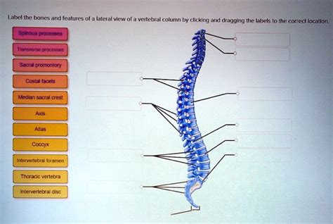 SOLVED: Label the bones and features of a lateral view of a vertebral ...