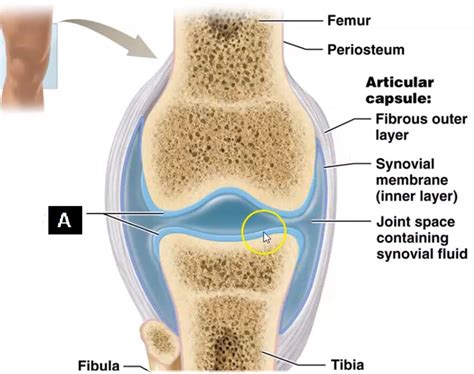 Name the structure of the Synovial Joint labeled "A":