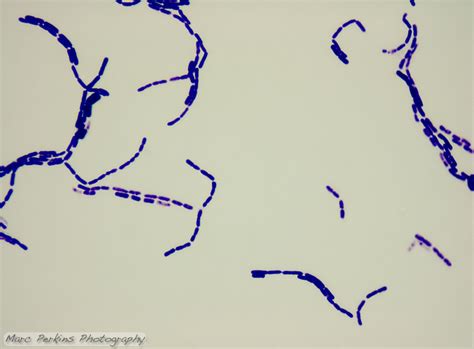 Gram Positive Bacilli In Chains