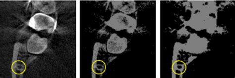 Several possible perceptions of the mandibular canal. It is clear ...