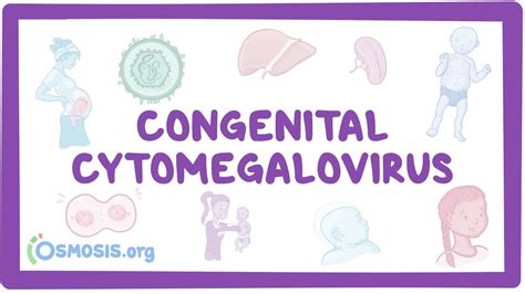 Congenital CMV - causes, symptoms, diagnosis, treatment, pathology ...