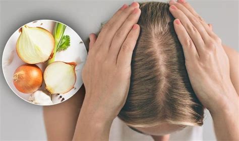 Hair loss treatment: Prevent alopecia and boost hair growth with onion ...