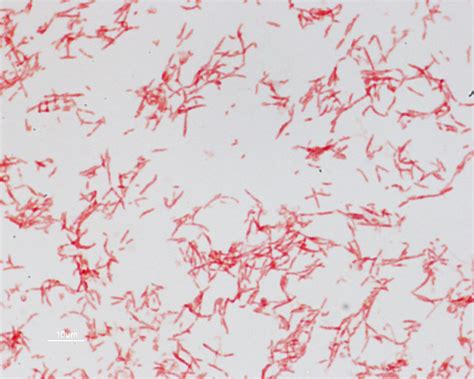 Bacteroides fragilis is pleomorphic | Colon cancer, Microbiology, Cancer