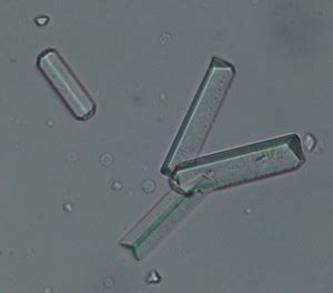 Magnesium ammonium phosphate crystals (struvite) | eClinpath